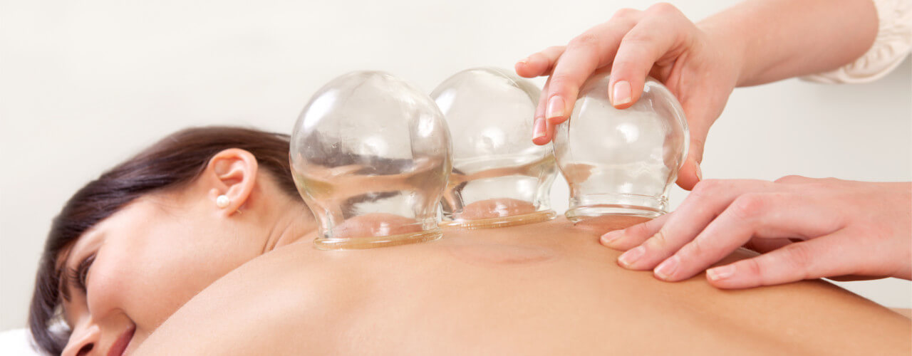 Cupping Greenwich, CT