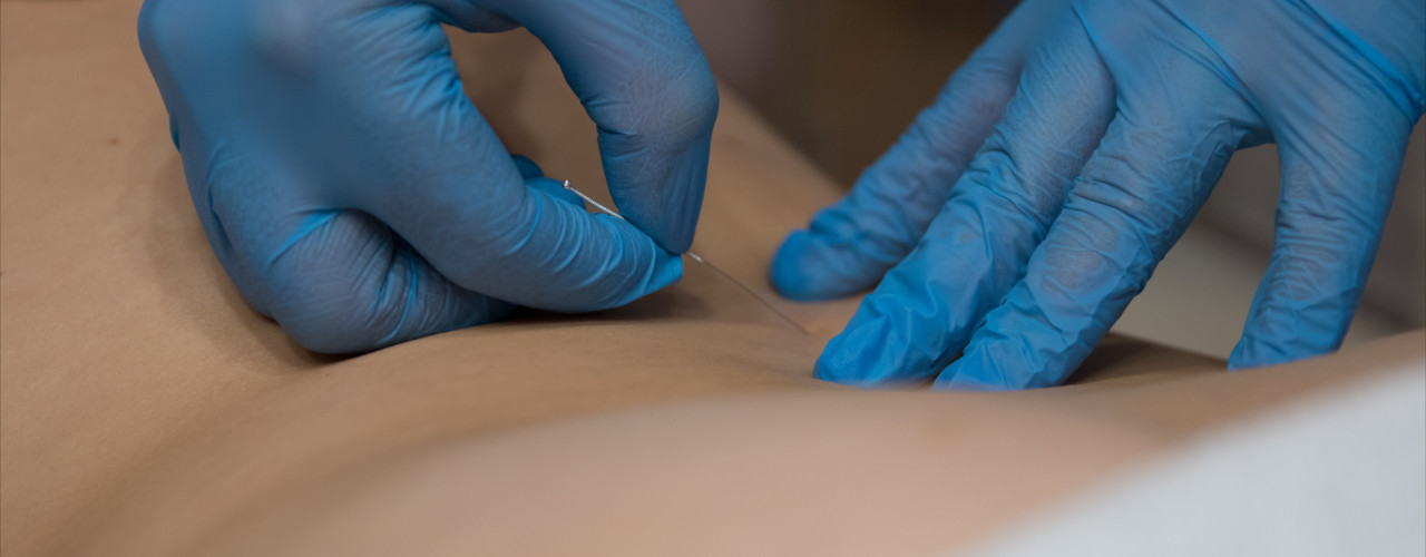 Elite-Health-Services-Physical-Therapy-Clinic-dry-needling-specialty-Greenwich-CT