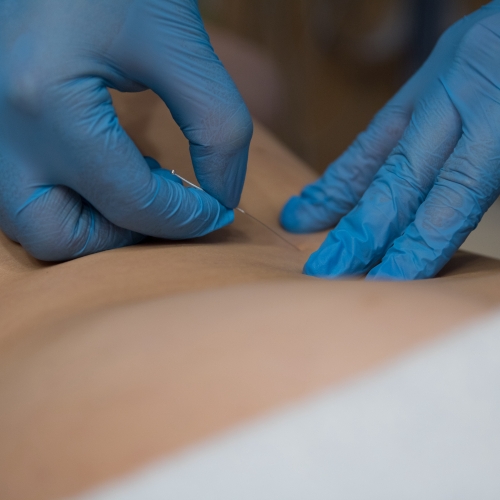 Elite-Health-Services-Physical-Therapy-Clinic-dry-needling-specialty-Greenwich-CT
